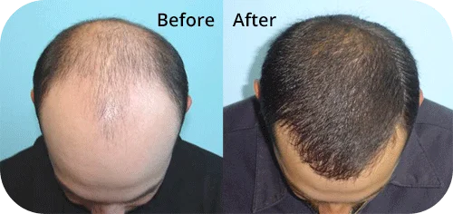 head-img